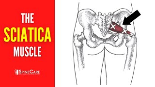 The Sciatica Muscle How to Release It for INSTANT RELIEF [upl. by Bendicta]