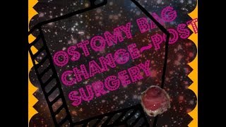 Ostomy Bag Change POST SURGERY [upl. by Balfore202]