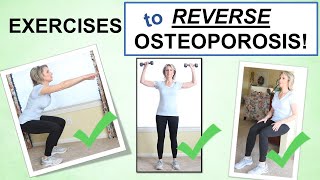 Reversing Osteoporosis Naturally Through Exercise – Best Exercises to Build Bone [upl. by Riegel532]