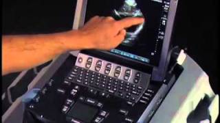 How to Echocardiography  Subcostal View [upl. by Olnek914]