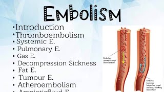 Embolism Pathology [upl. by Ahsirkal]