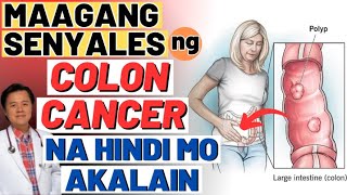 Maagang Senyales ng Colon Cancer na Hindi Mo Akalain  Tips By Doc Willie Ong [upl. by Eillek]