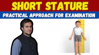 Short stature case examinationapproach clinical methodsbest approach and differential diagnosis [upl. by Jaan]