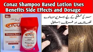 Conaz Shampoo for Dandruff and Hair Fall  Best Anti Dandruff Shampoo  Ketoconazol shampoo Benefits [upl. by Ojahtnamas]