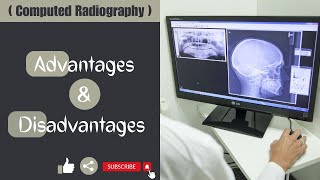 Advantages amp Disadvantages of Computed Radiography computedRadiograpy [upl. by Joseph]