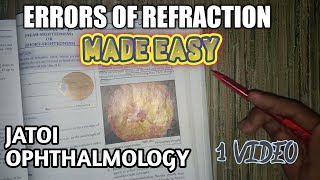 Errors of refraction  Eye  ophthalmology lectures [upl. by Hassin]