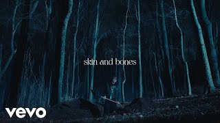 David Kushner  Skin and Bones Official Lyric Video [upl. by Airdnoed]