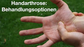 Handarthrose konservative und operative Möglichkeiten [upl. by Treb966]