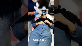 Carban peel treatment minivlog ytshort youtubeshorts manojdayshorts Noorikilife [upl. by Iuqcaj]