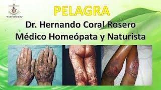 PELAGRA DEFICIENCIA DE NIACINA DERMATITIS [upl. by Dillon532]