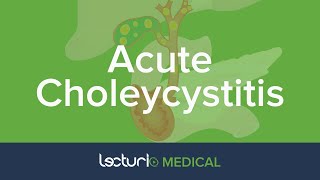 Acute Choleycystitis Overview and Practice Case  Gastroenterology [upl. by Britteny]