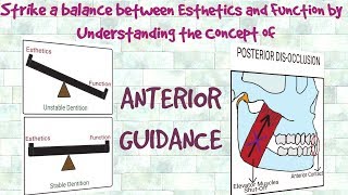 Anterior Guidance  Understanding the Concept [upl. by Preiser292]