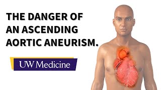 Surgeon describes an ascending aortic aneurysm  UW Medicine [upl. by Mays221]