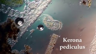 Kerona pediculus [upl. by Anidem]