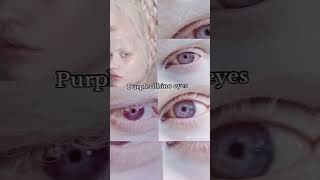 Types of eye color 👁️ 22 🅢︎🅤︎🅑︎🅢︎🅒︎🅡︎🅘︎🅑︎🅔︎ trending Sarahofficialy7p billionviews [upl. by Eardnoed]