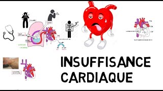 insuffisance cardiaque de A à Z [upl. by Einaled875]