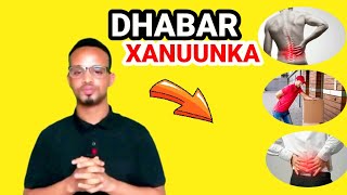 Dhabar Xanuunka Sida La Isaga Daweeyo [upl. by Jalbert]