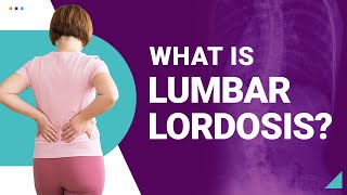 What is Lumbar Lordosis [upl. by Aitsirt]