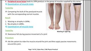 Physio pract5 Motor Examination CNS 41 [upl. by Dolf861]