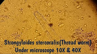 Strongyloides stercoralis under microscopeStool MicroscopyView at 10 and 40XThreadworm microscopy [upl. by Woodall]