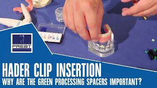 Hader Clip Insertion  Why Are Processing Spacers Important By PREAT Corporation [upl. by Elakram]