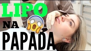 LIPO NA PAPADA LIPOPLASTIA FACIAL [upl. by Harts626]