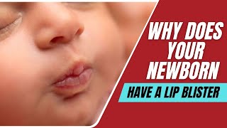 Why Your Newborn Might Have A Lip Blister [upl. by Nura]