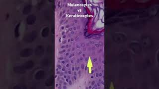 Melanocytes vs Keratinocytes From my normal skin histology 101 video pathology dermpath usmle [upl. by Ainak60]