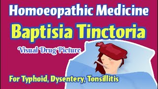 Baptisia Tinctoria 30 Homoeopathic Medicine Uses  Baptisia Mother Tincture  Baptisia Drug Picture [upl. by Eilsehc]