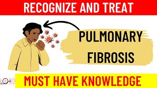 Pulmonary Fibrosis and ILD Treatment Options [upl. by Seaden457]