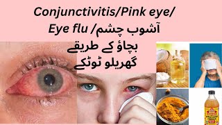 Conjunctivitis Causes symptoms and treatment of conjunctivitis [upl. by Celisse688]