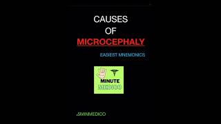 MICROCEPHALY CAUSES  PEDIATRICS EASIEST MNEMONIC 5MINMEDICO next neetpg shorts [upl. by Oigres120]