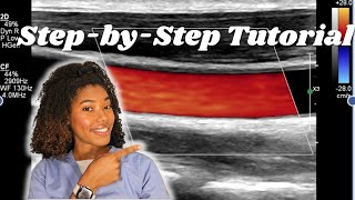 How to Perform Carotid Ultrasounds  A Simple Guide for Beginners [upl. by Hippel]