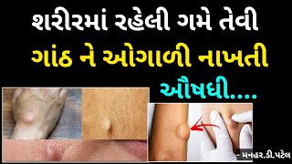 શરીર માં રહેલી ગમે તેવી ગાંઠ ને ઓગળી નાખતી ઔષધી 💯 ManharDPatel [upl. by Melas]