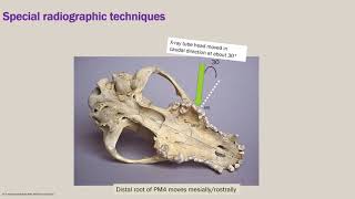 Dental Radiographic Interpretation 1 Normal Anatomy [upl. by Miller450]