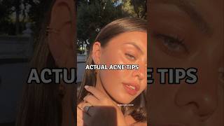 6 Actual Acne Tips viralshorts acnetreatment acnescars [upl. by Hjerpe251]