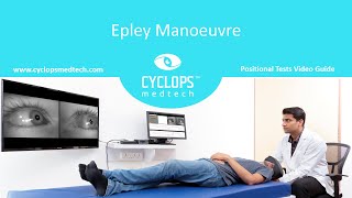 Epley Manoeuvre [upl. by Enyaw]