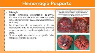 Hemorragia Posparto 12  Ginecología [upl. by Scutt]