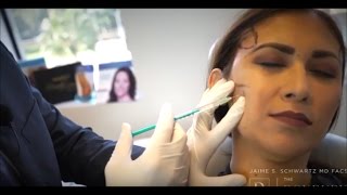 Botox Treatment for TMJ Pain [upl. by Fanchette]