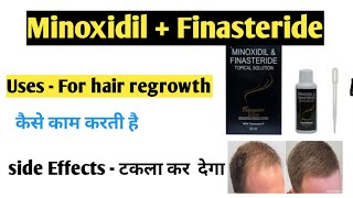 Minoxidil  Finasteride  Minoxidil Finasteride topical Solution  Full details  Shubham Singh [upl. by Marra67]