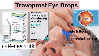 Travoprost Eye Drops  travoprost ip drops [upl. by Rihsab435]