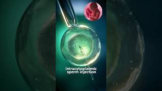 intracytoplasmic sperm injection [upl. by Mahalia]