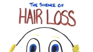 The Science of Hair LossBalding [upl. by Leontine]