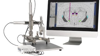 Neurostar  Robot Stereotaxic [upl. by Farrar]
