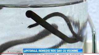 Terapia cu lipitori cea mai nouă metodă de tratament [upl. by Erodoeht101]