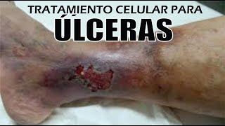 🔴 DERMATITIS PERIORAL ¡GRANITOS o IRRITACIÓN ALREDEDOR de la BOCA drapilarochoa  Dermatologa [upl. by Mylander156]