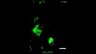 Le mécanisme d’un candidat vaccin antisida filmé in vivo [upl. by Eta]