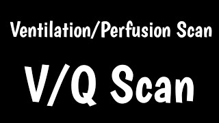 VQ Scan  VentilationPerfusion Scan  VQ Ratio [upl. by Atile676]