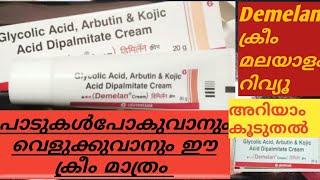 Demelan cream malayalam review [upl. by Weisler749]