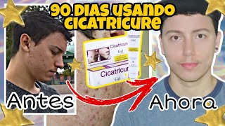 El mejor tratamiento para eliminar CICATRICES de ACNÉ Use CICATRICURE por 90 días y ¡esto pasó [upl. by Romelle280]